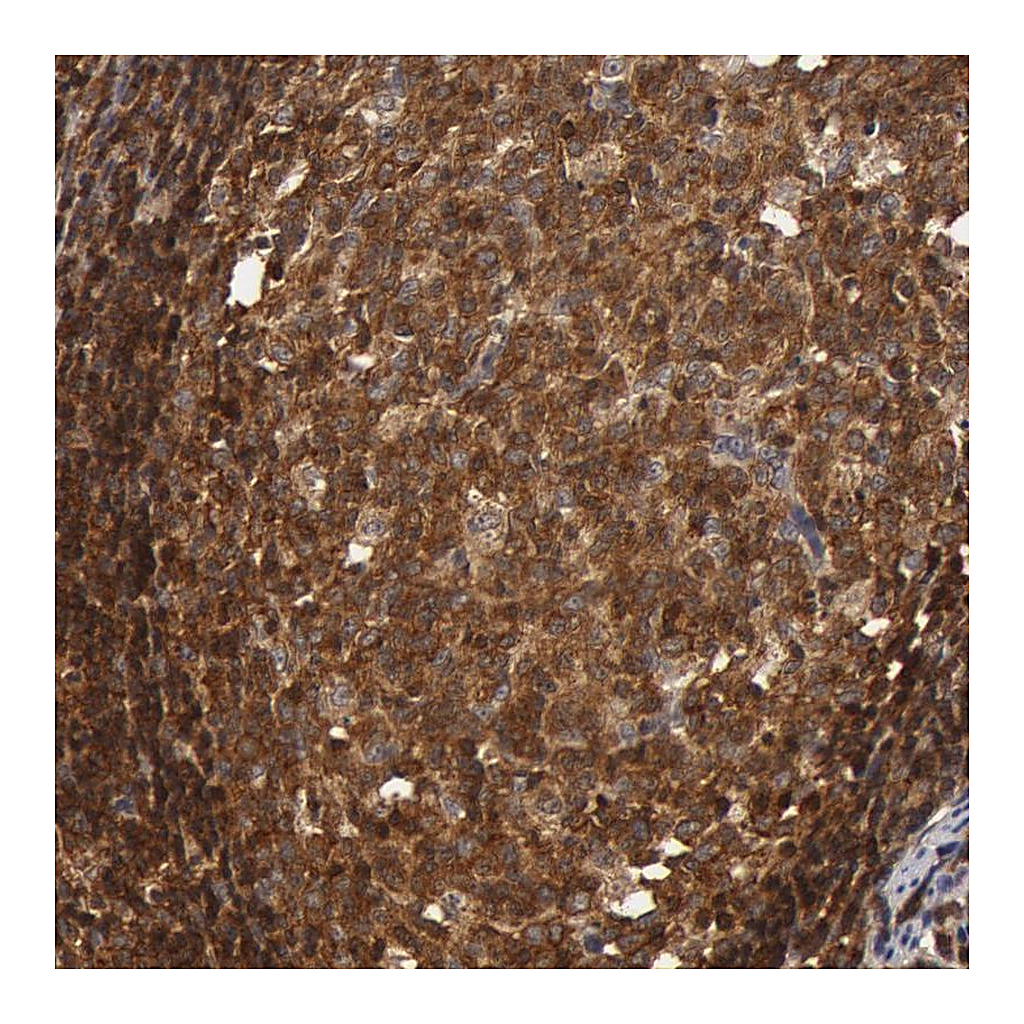 Atlas Antibodies Anti-ZNF350 Antibody