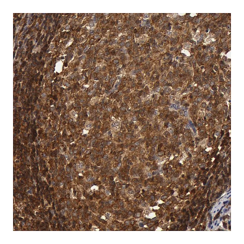 Atlas Antibodies Anti-ZNF350 Antibody