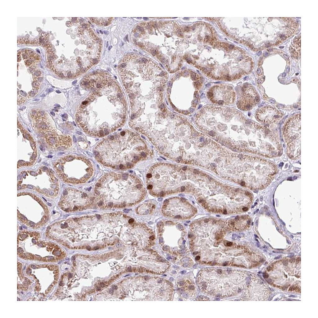 Atlas Antibodies Anti-ZNF354A Antibody