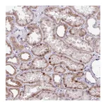 Atlas Antibodies Anti-ZNF354A Antibody