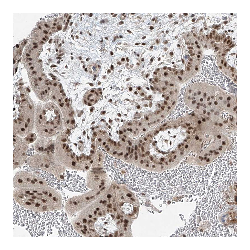 Atlas Antibodies Anti-ZNF354B Antibody