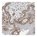 Atlas Antibodies Anti-ZNF354B Antibody