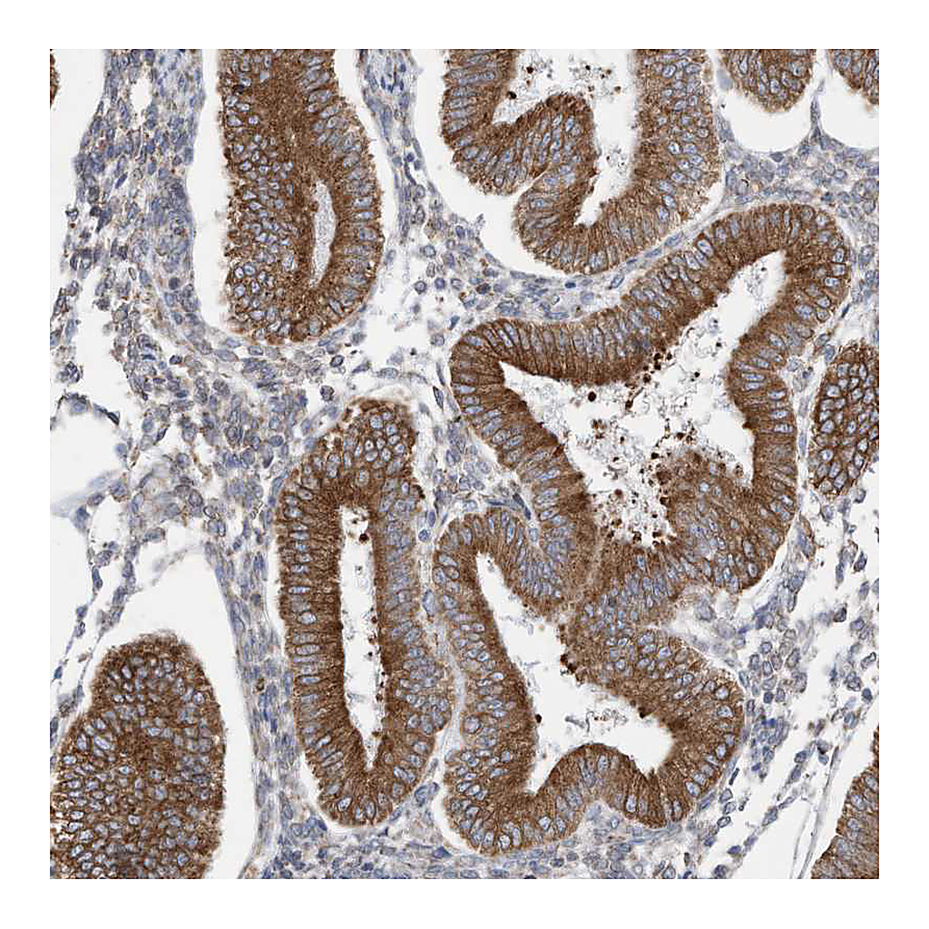 Atlas Antibodies Anti-ZNF354C Antibody