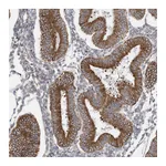 Atlas Antibodies Anti-ZNF354C Antibody