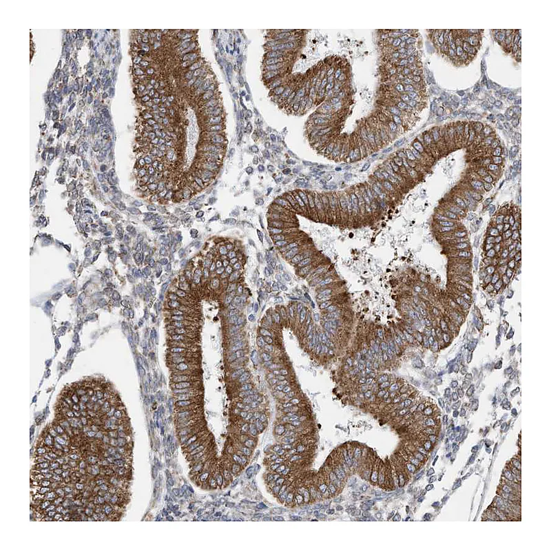 Atlas Antibodies Anti-ZNF354C Antibody