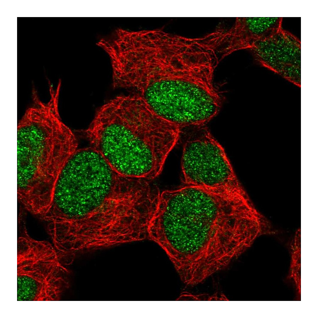 Atlas Antibodies Anti-ZNF358 Antibody