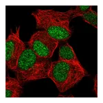Atlas Antibodies Anti-ZNF358 Antibody