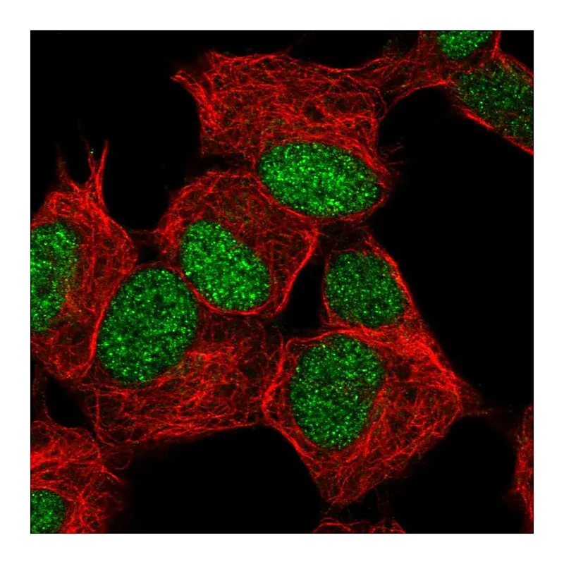 Atlas Antibodies Anti-ZNF358 Antibody