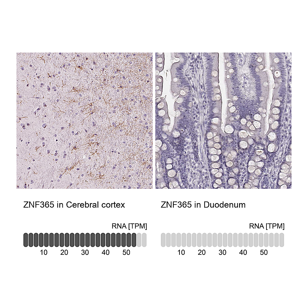 Atlas Antibodies Anti-ZNF365 Antibody