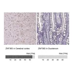 Atlas Antibodies Anti-ZNF365 Antibody