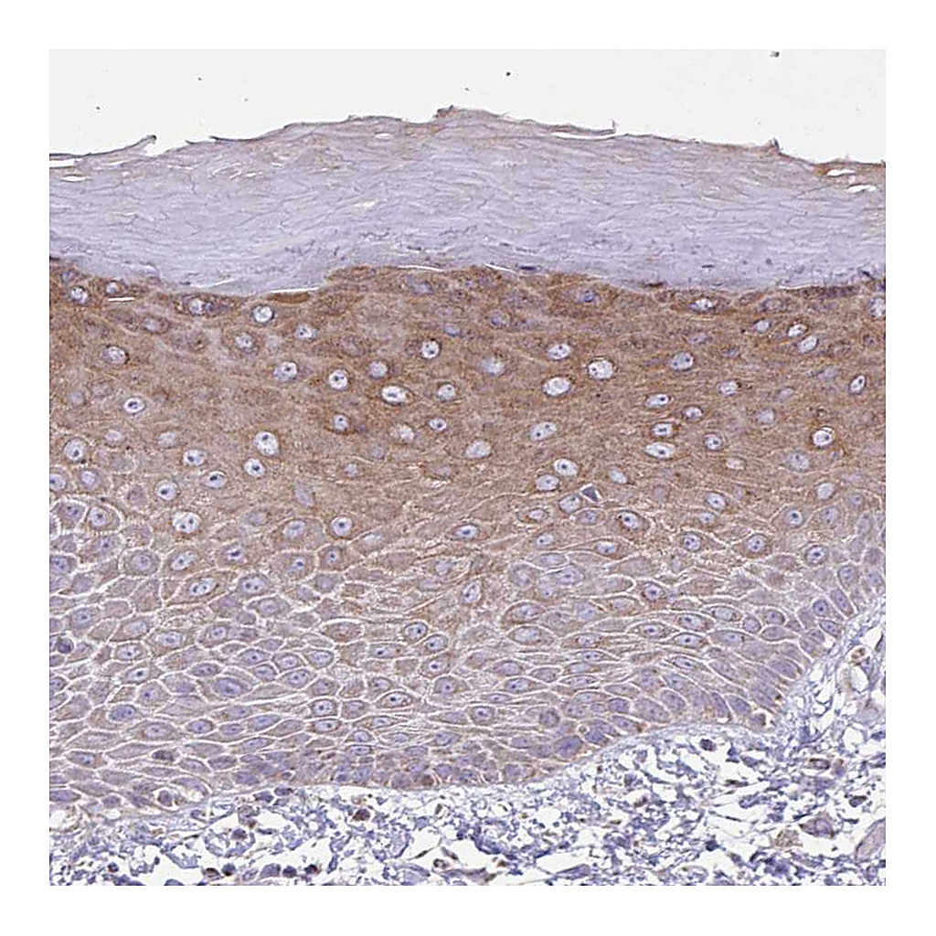 Atlas Antibodies Anti-ZNF362 Antibody