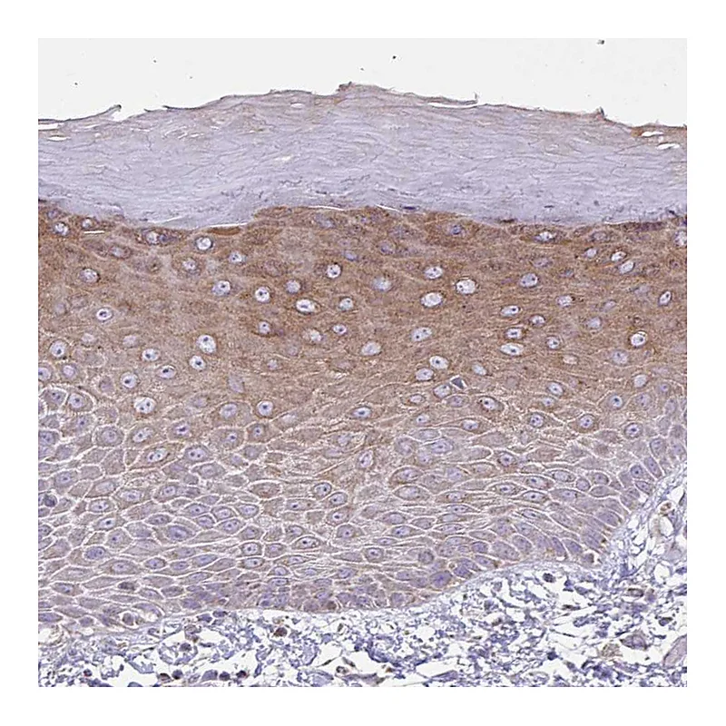 Atlas Antibodies Anti-ZNF362 Antibody