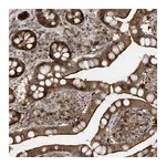 Atlas Antibodies Anti-ZNF358 Antibody