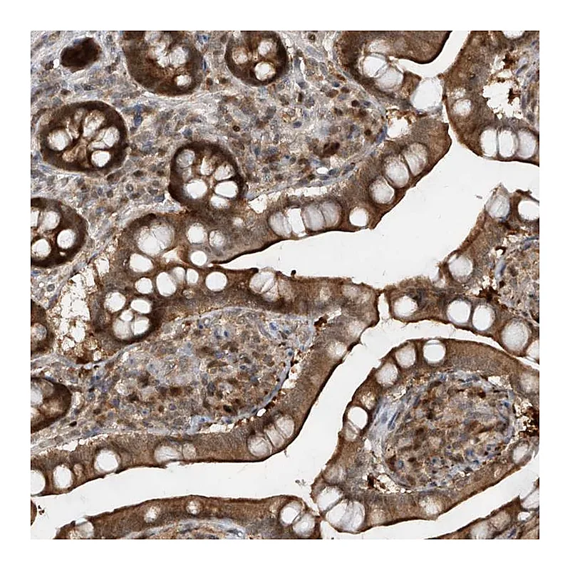 Atlas Antibodies Anti-ZNF358 Antibody