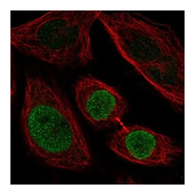 Atlas Antibodies Anti-ZNF354C Antibody