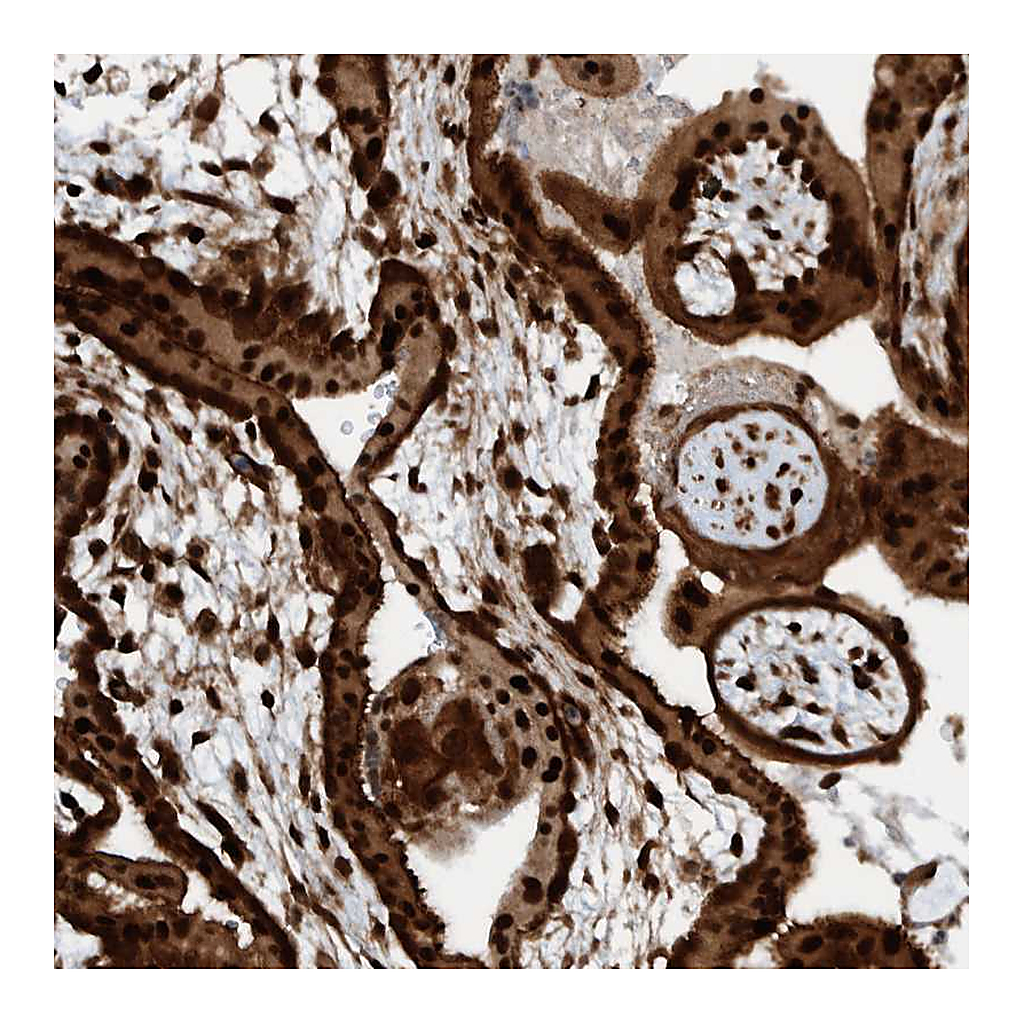 Atlas Antibodies Anti-ZNF366 Antibody