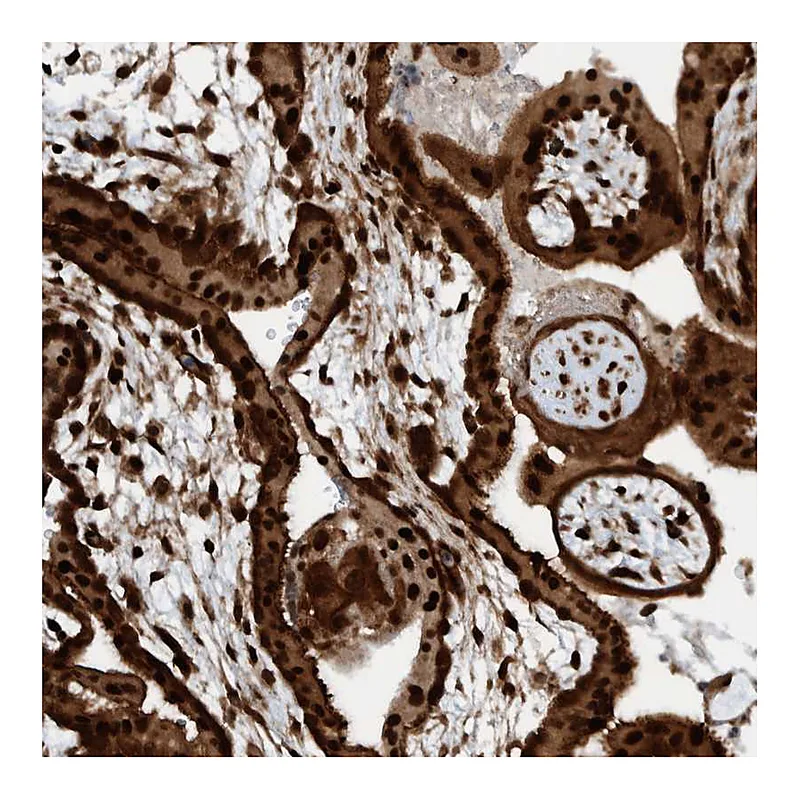 Atlas Antibodies Anti-ZNF366 Antibody