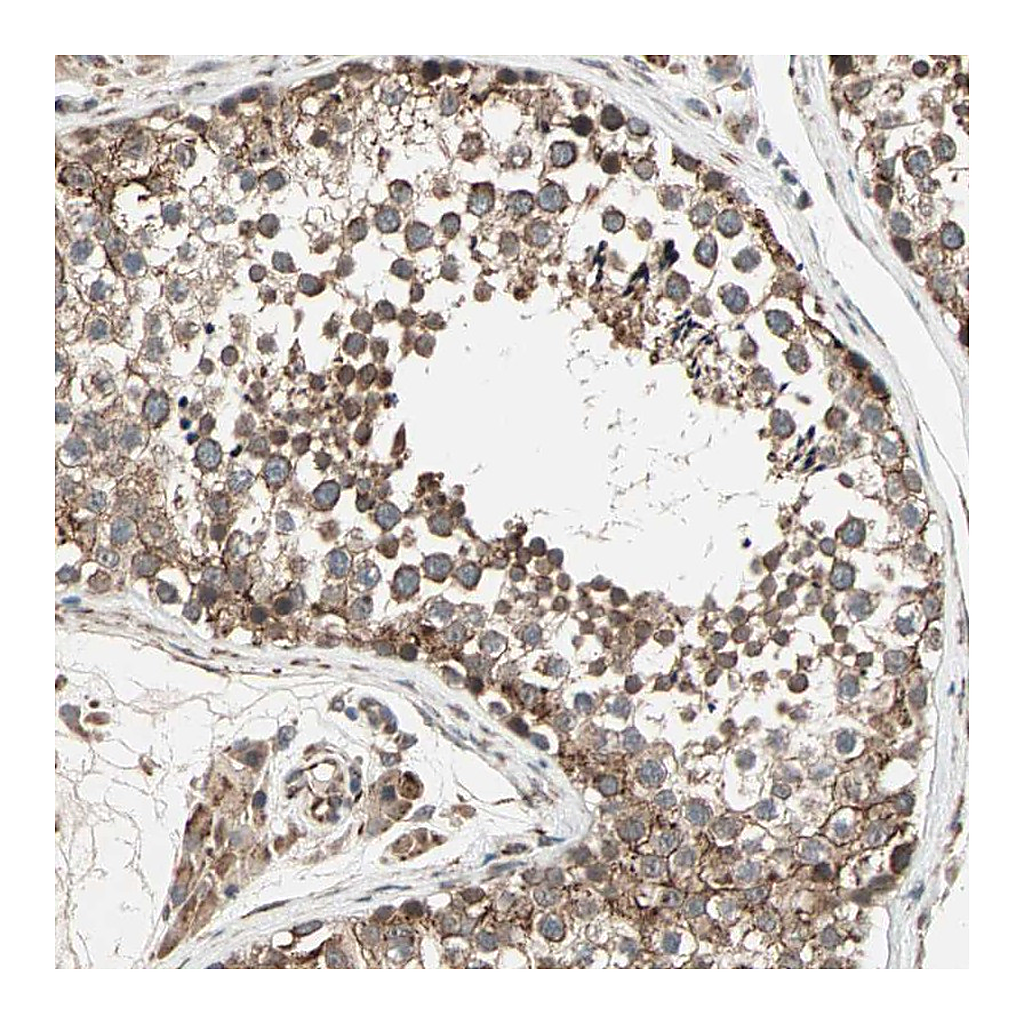 Atlas Antibodies Anti-ZNF37A Antibody
