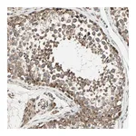 Atlas Antibodies Anti-ZNF37A Antibody