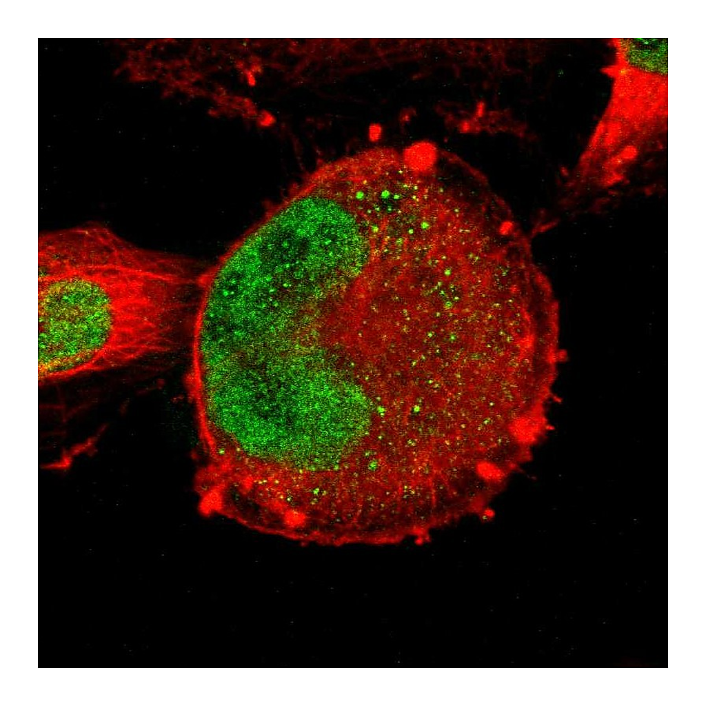 Atlas Antibodies Anti-ZNF367 Antibody