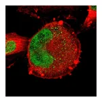 Atlas Antibodies Anti-ZNF367 Antibody