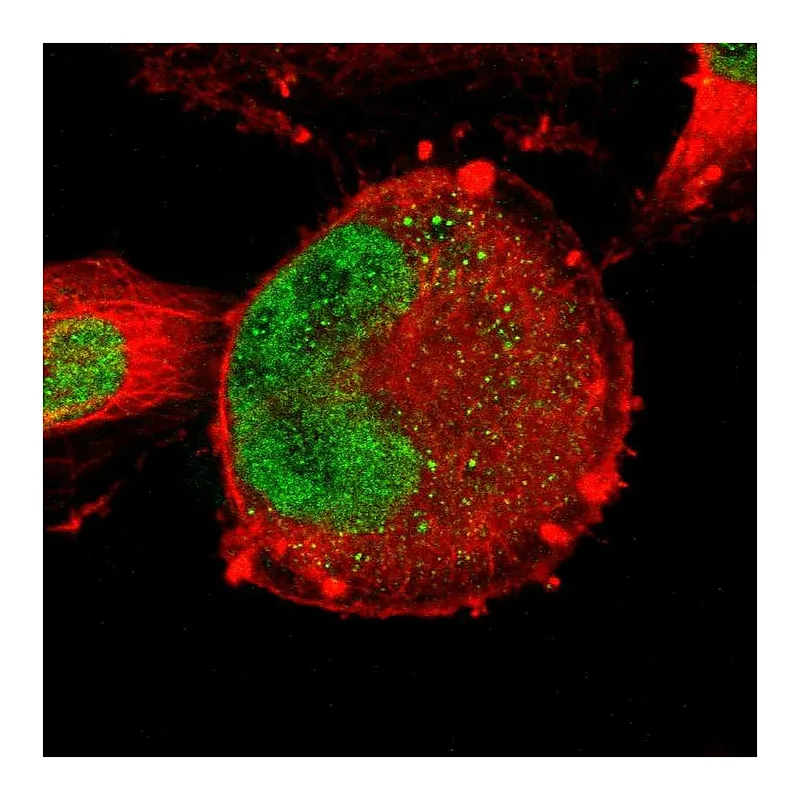 Atlas Antibodies Anti-ZNF367 Antibody