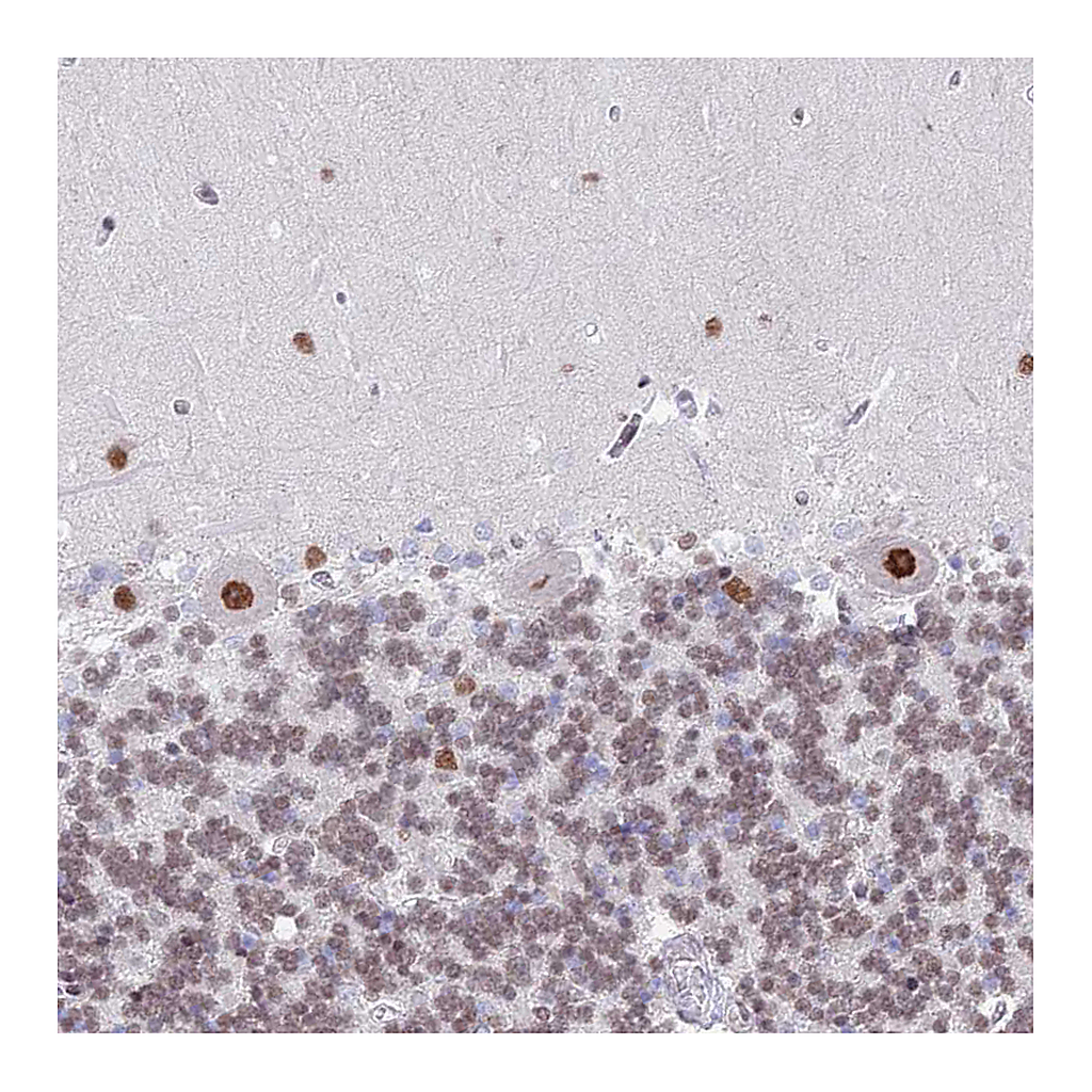 Atlas Antibodies Anti-ZNF382 Antibody