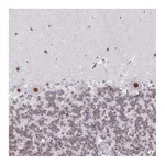 Atlas Antibodies Anti-ZNF382 Antibody