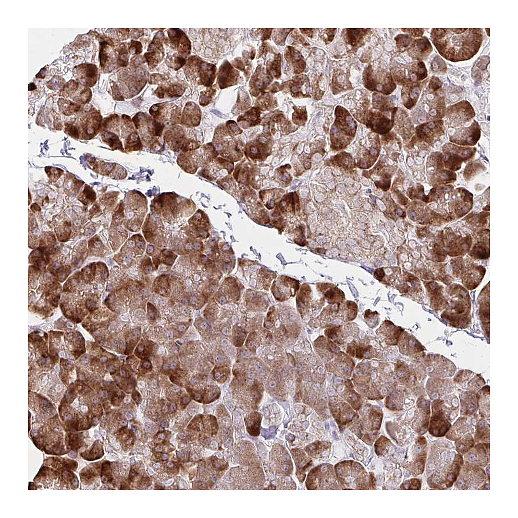 Atlas Antibodies Anti-ZNF383 Antibody