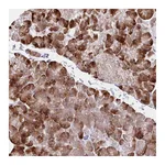 Atlas Antibodies Anti-ZNF383 Antibody