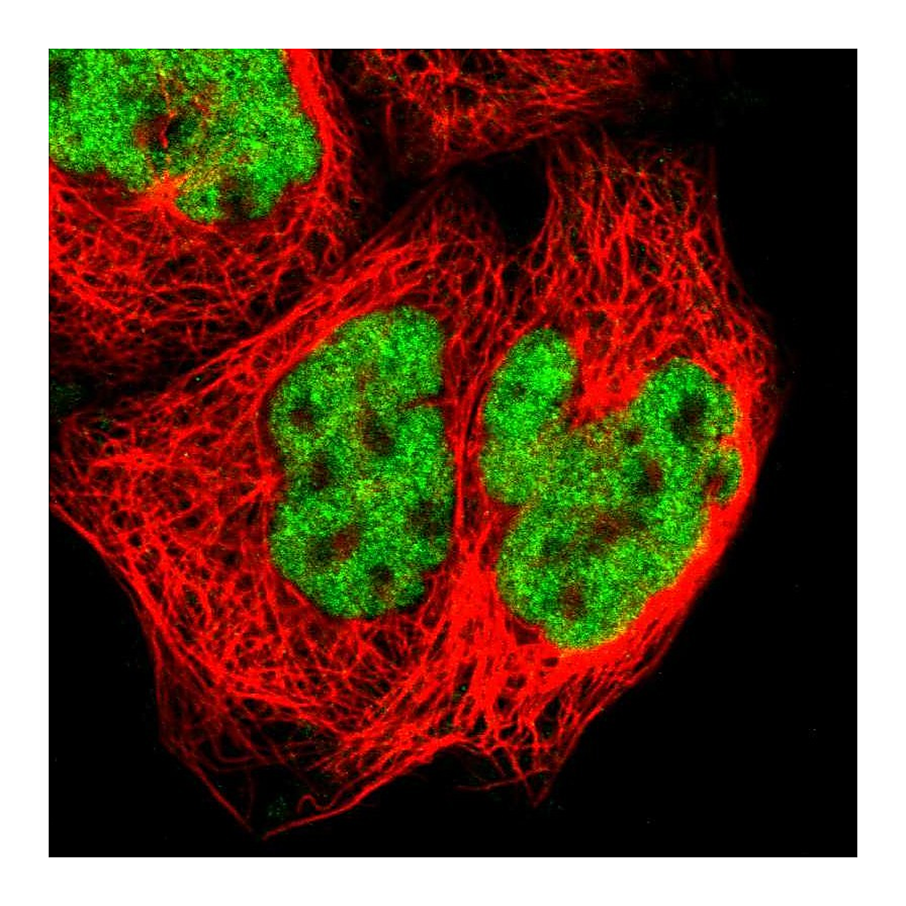Atlas Antibodies Anti-ZNF384 Antibody