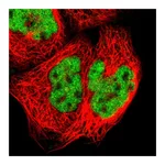 Atlas Antibodies Anti-ZNF384 Antibody