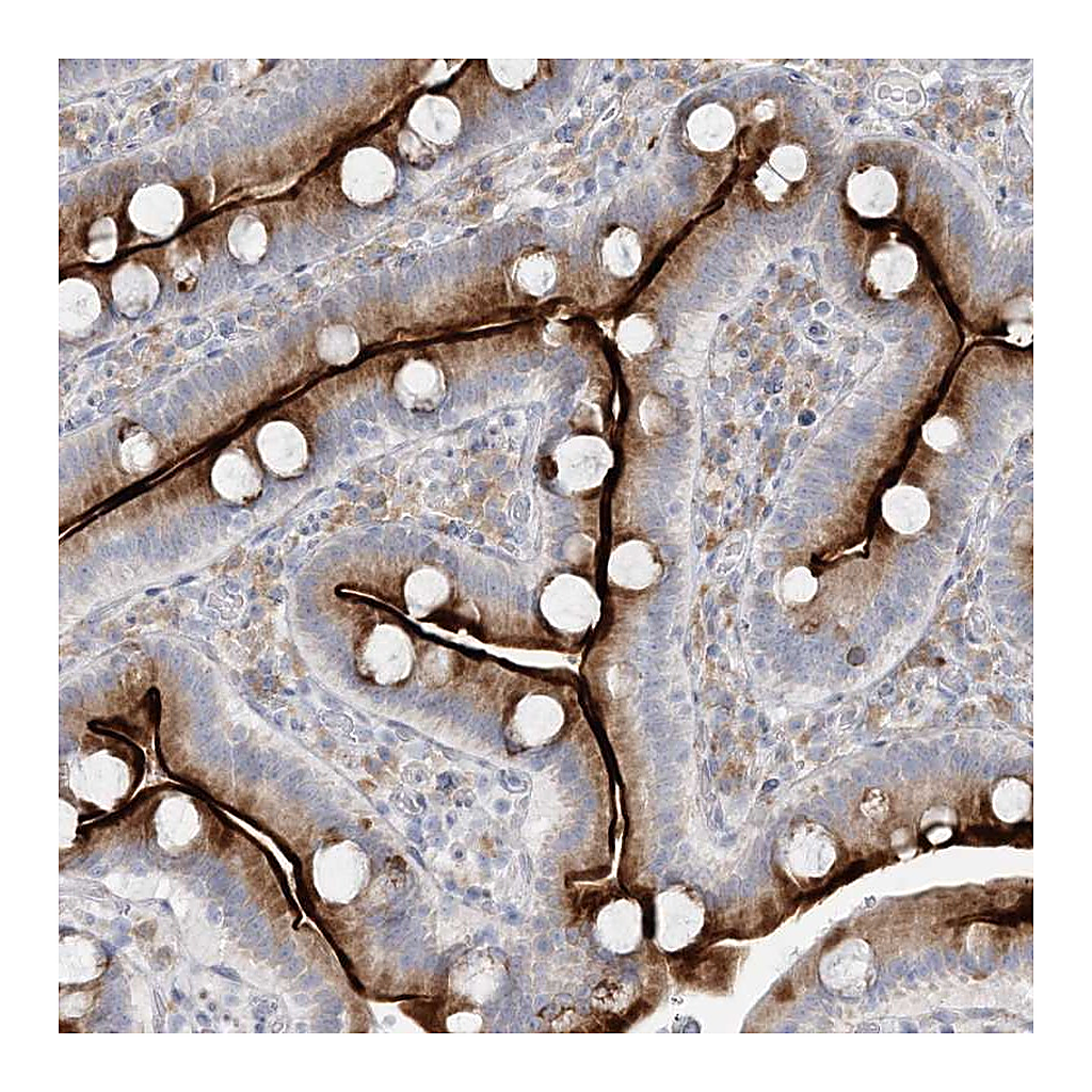 Atlas Antibodies Anti-ZNF385D Antibody