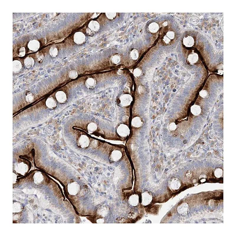 Atlas Antibodies Anti-ZNF385D Antibody