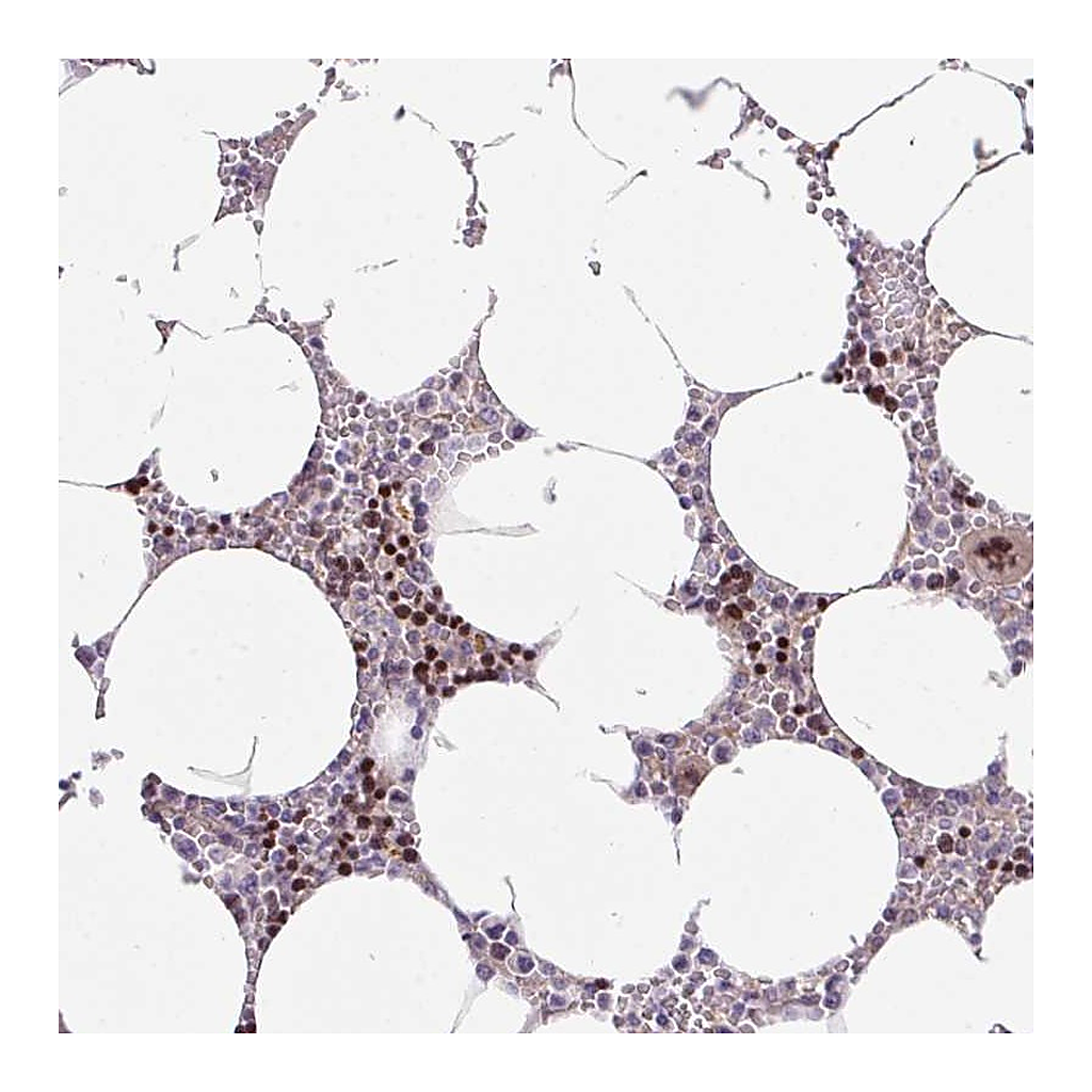 Atlas Antibodies Anti-ZNF394 Antibody