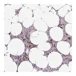 Atlas Antibodies Anti-ZNF394 Antibody