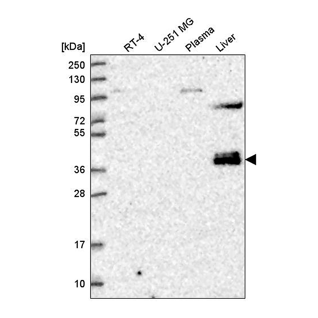 Atlas Antibodies Anti-ZNF385B Antibody