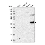 Atlas Antibodies Anti-ZNF385B Antibody
