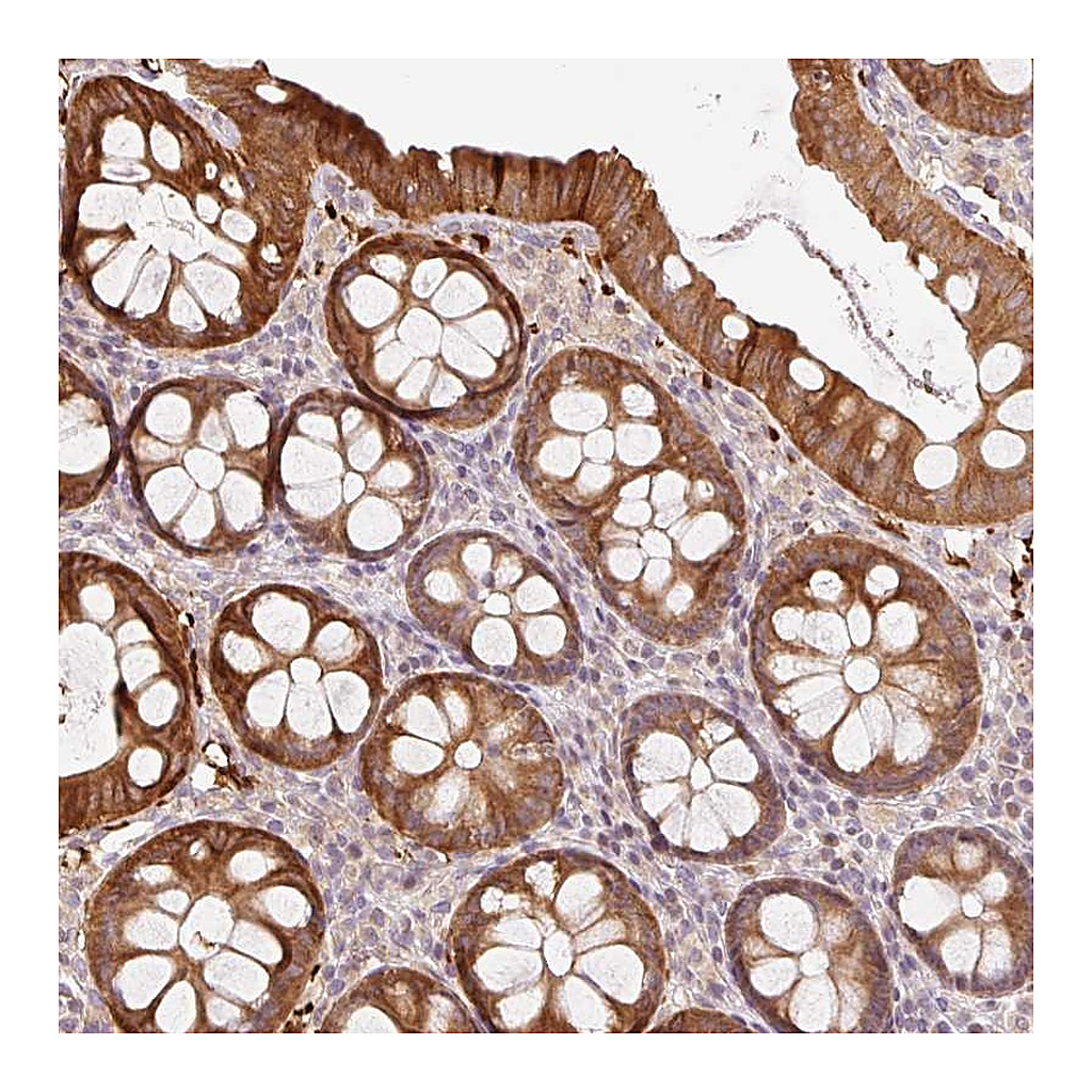 Atlas Antibodies Anti-ZNF394 Antibody