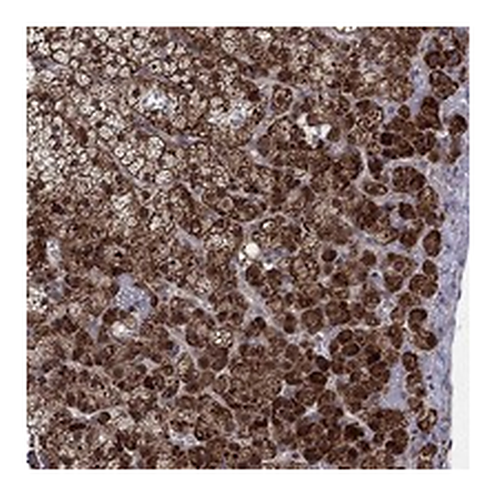 Atlas Antibodies Anti-ZNF395 Antibody