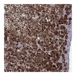 Atlas Antibodies Anti-ZNF395 Antibody