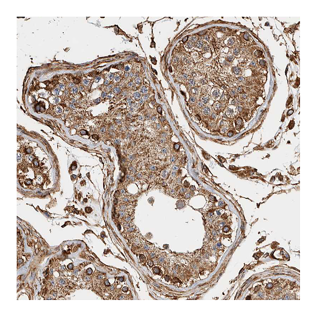 Atlas Antibodies Anti-ZNF397 Antibody