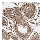 Atlas Antibodies Anti-ZNF397 Antibody