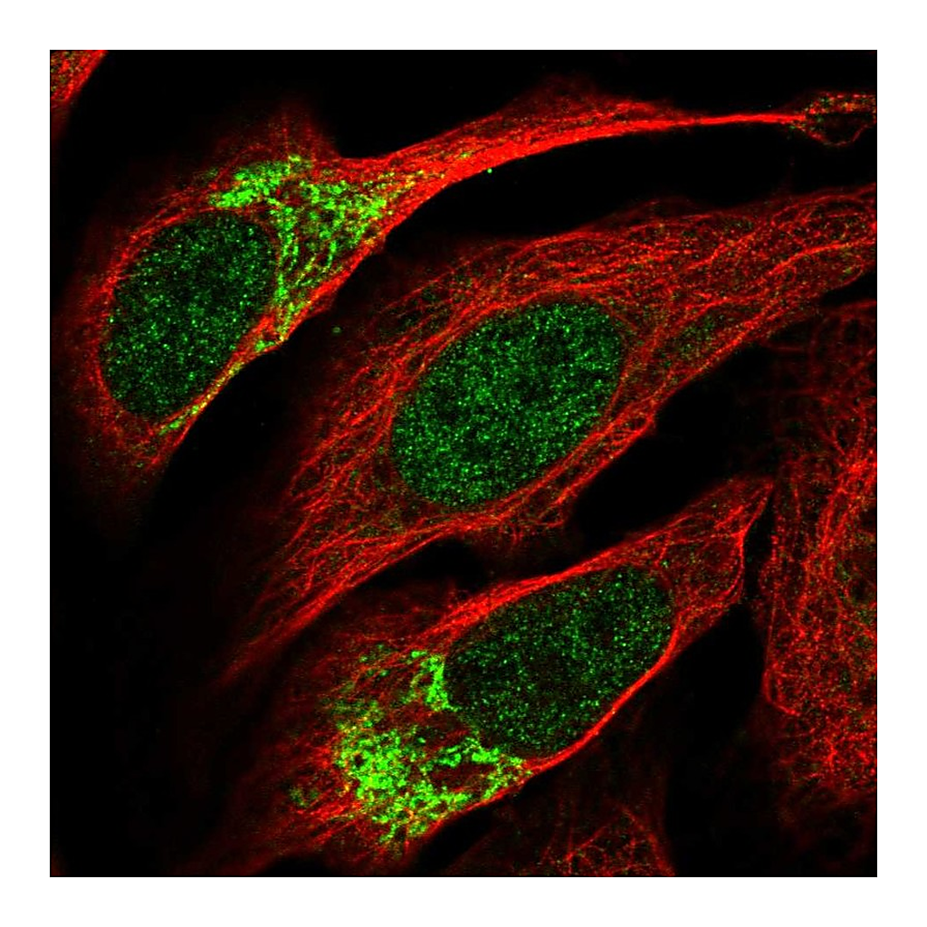 Atlas Antibodies Anti-ZNF398 Antibody