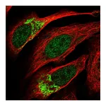 Atlas Antibodies Anti-ZNF398 Antibody