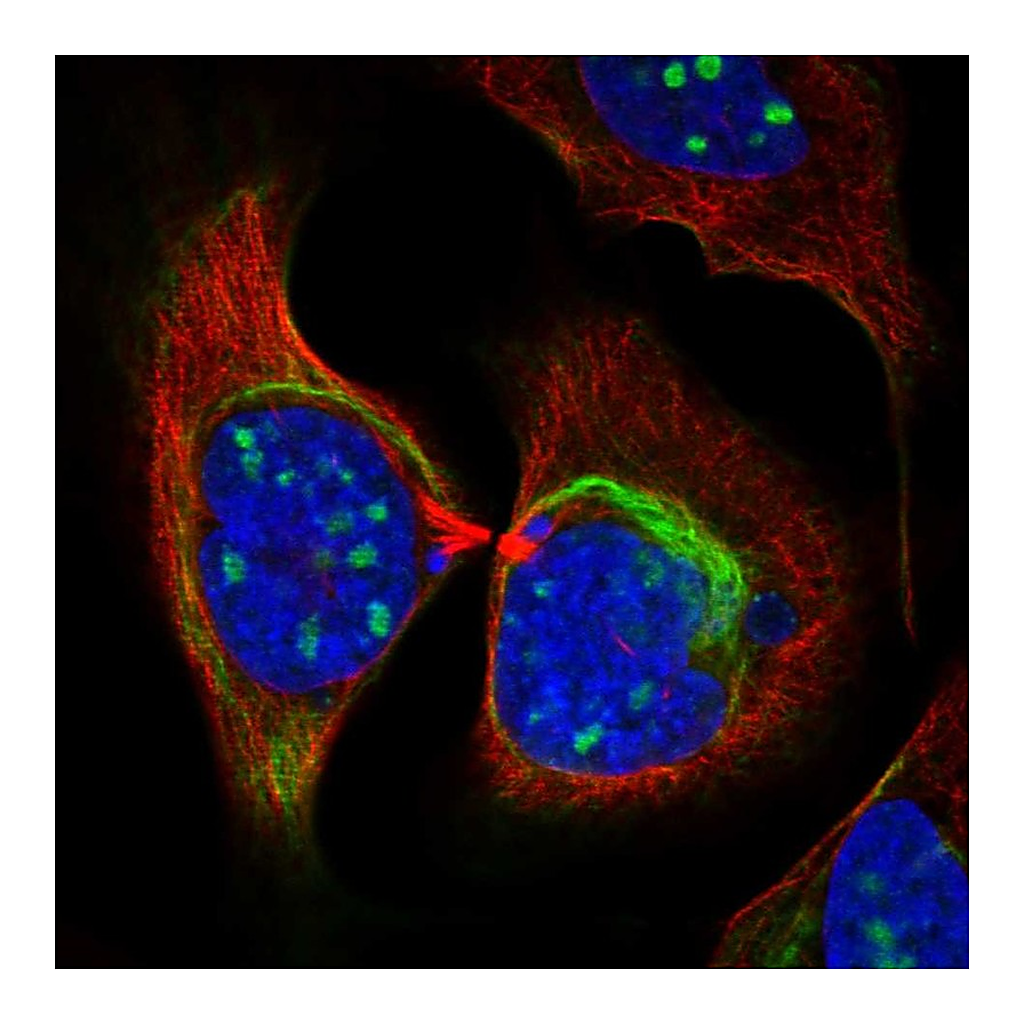Atlas Antibodies Anti-ZNF404 Antibody