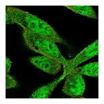 Atlas Antibodies Anti-ZNF407 Antibody