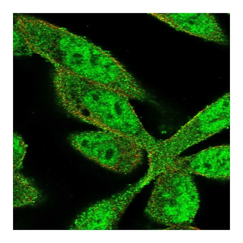 Atlas Antibodies Anti-ZNF407 Antibody