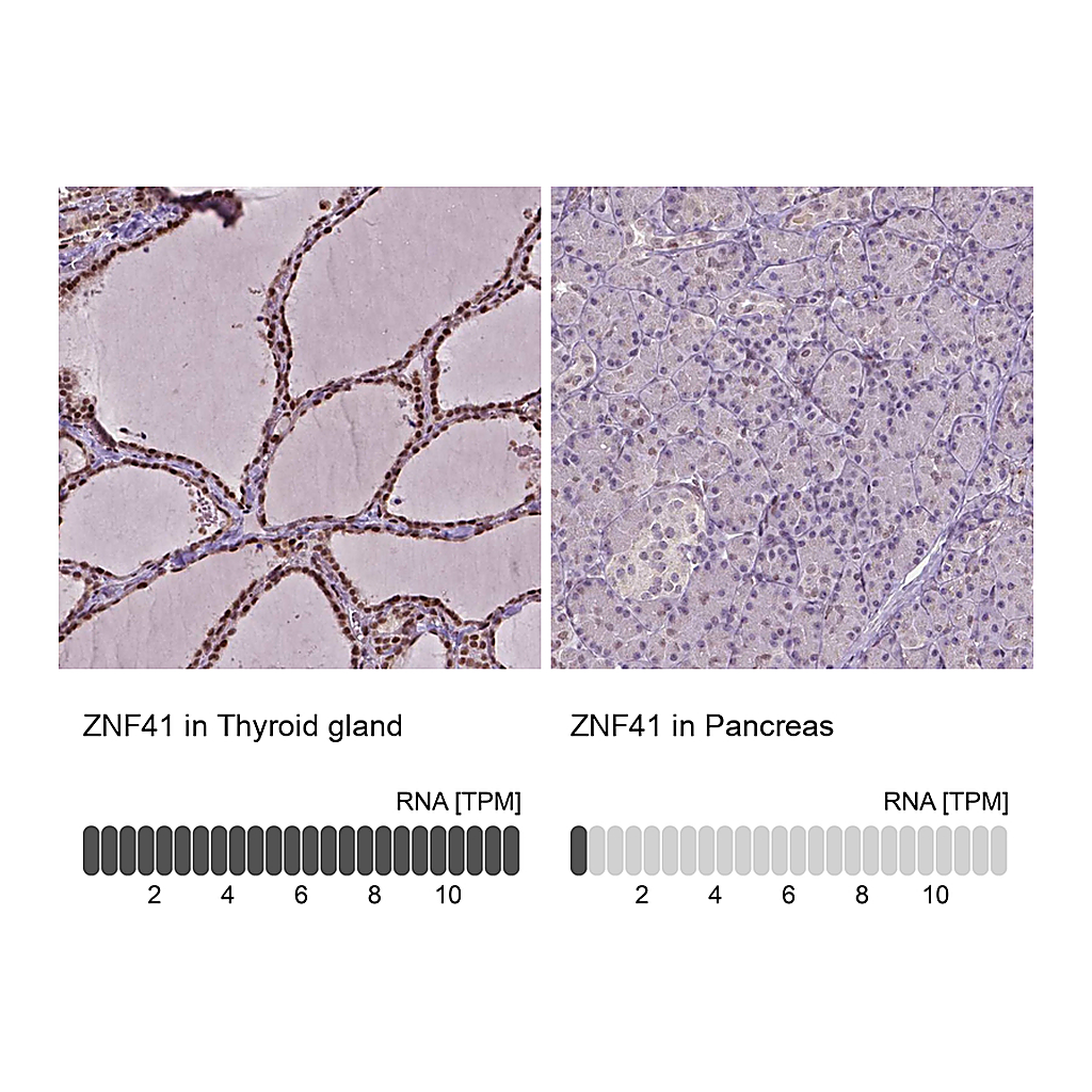 Atlas Antibodies Anti-ZNF41 Antibody