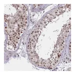 Atlas Antibodies Anti-ZNF414 Antibody